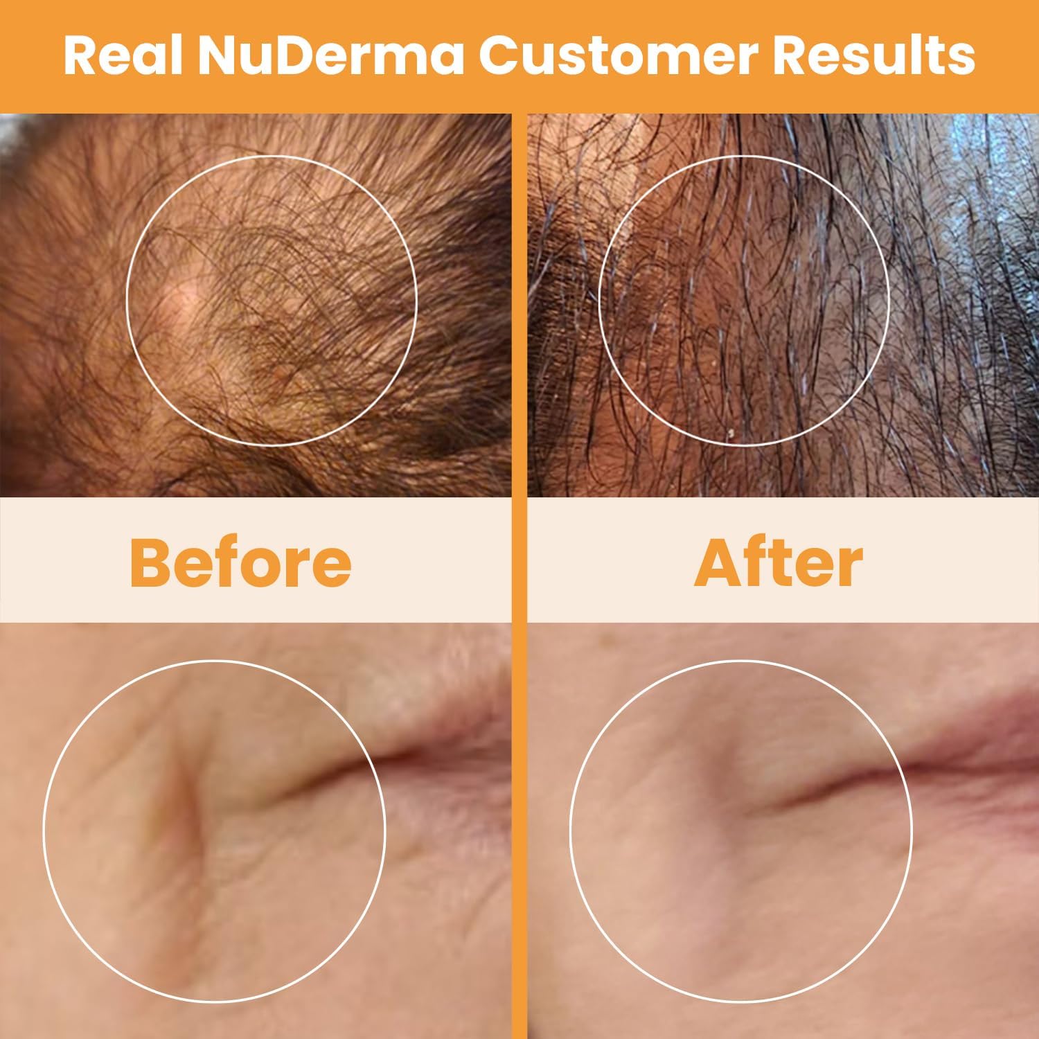 Pure Daily Care NuDerma Handheld Skin Therapy Wand Machine w/Neon – Anti-Aging - Skin Tightening - Wrinkle Reducing - Dark Circles – Clarifying - Hair & Scalp Stimulator - Image 7