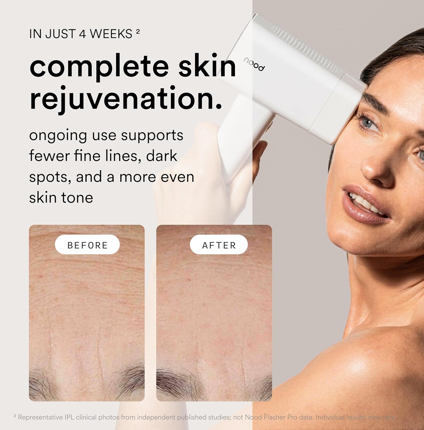 Nood™ NEW Flasher Pro — IPL Laser Hair Removal Device & Anti-Aging Red Light Therapy for Women & Men — Pain-free, Permanent, Visible Results After First Use & Works Everywhere Hair Grows — Gloss White - Image 4
