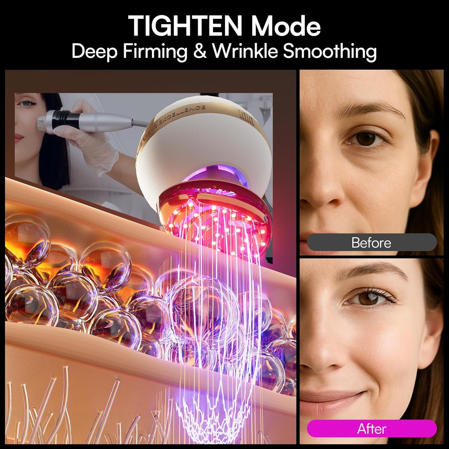 INIA SPHERA Upgraded 8-in-1 Microcurrent Facial Device for Face & Neck – Red Light, Thermal & Cooling Beauty Tool, 5 Custom Modes, At-Home Skin Stimulation & Glow Care Skincare Tool - Image 6