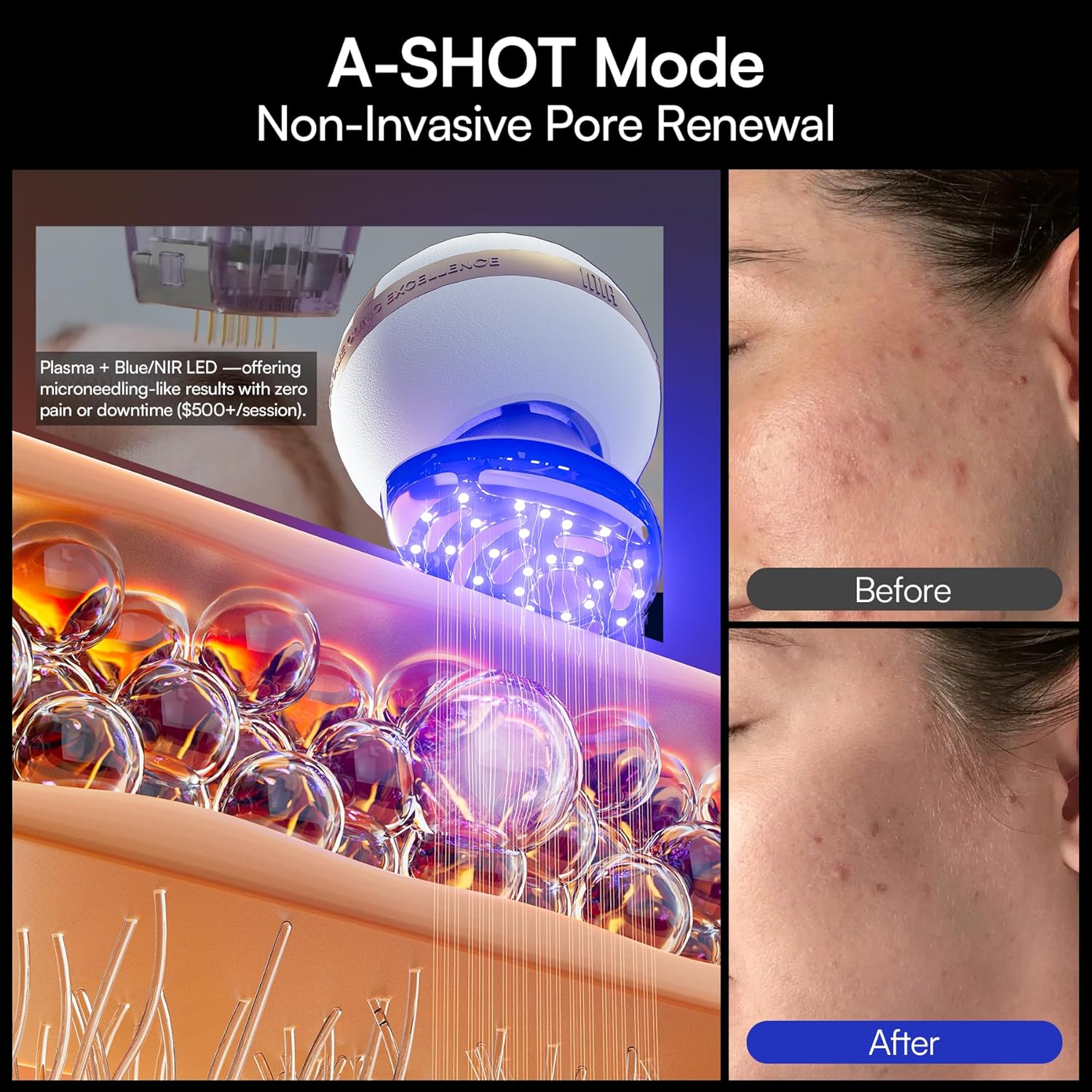 INIA SPHERA Upgraded 8-in-1 Microcurrent Facial Device for Face & Neck – Red Light, Thermal & Cooling Beauty Tool, 5 Custom Modes, At-Home Skin Stimulation & Glow Care Skincare Tool - Image 8