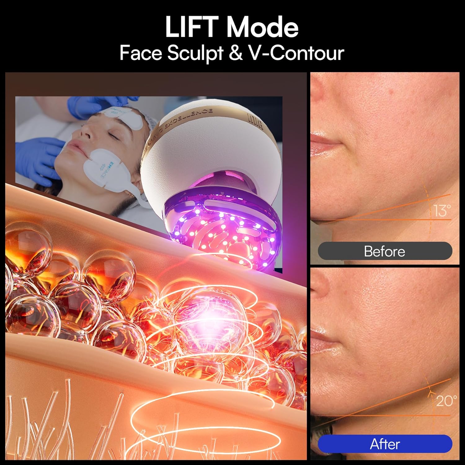 INIA SPHERA Upgraded 8-in-1 Microcurrent Facial Device for Face & Neck – Red Light, Thermal & Cooling Beauty Tool, 5 Custom Modes, At-Home Skin Stimulation & Glow Care Skincare Tool - Image 5