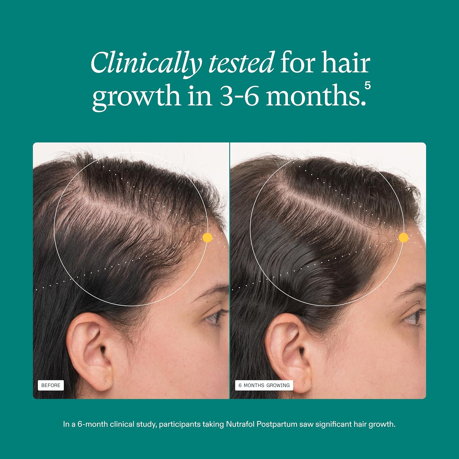 Nutrafol Postpartum Hair Growth Supplements, Clinically Tested for Visibly Thicker Hair and Less Shedding, Breastfeeding-Friendly - 2 Month Supply, 2 Refill Pouches - Image 4