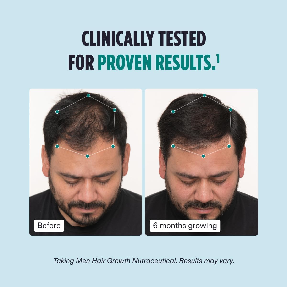 Nutrafol Men's Hair Growth Supplement and Hair Serum, Clinically Tested for Visible Thickness and Strength - 1 Month Supply, 1.7 Fl Oz Bottle - Image 4