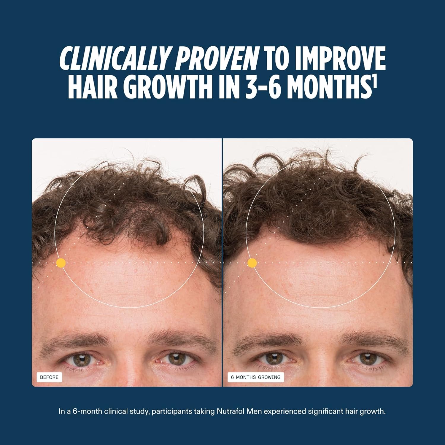 Nutrafol Men's Hair Growth Supplements, Clinically Tested for Visibly Thicker Hair and Scalp Coverage, Dermatologist Recommended - 2 Month Supply, Pack of 2 - Image 4